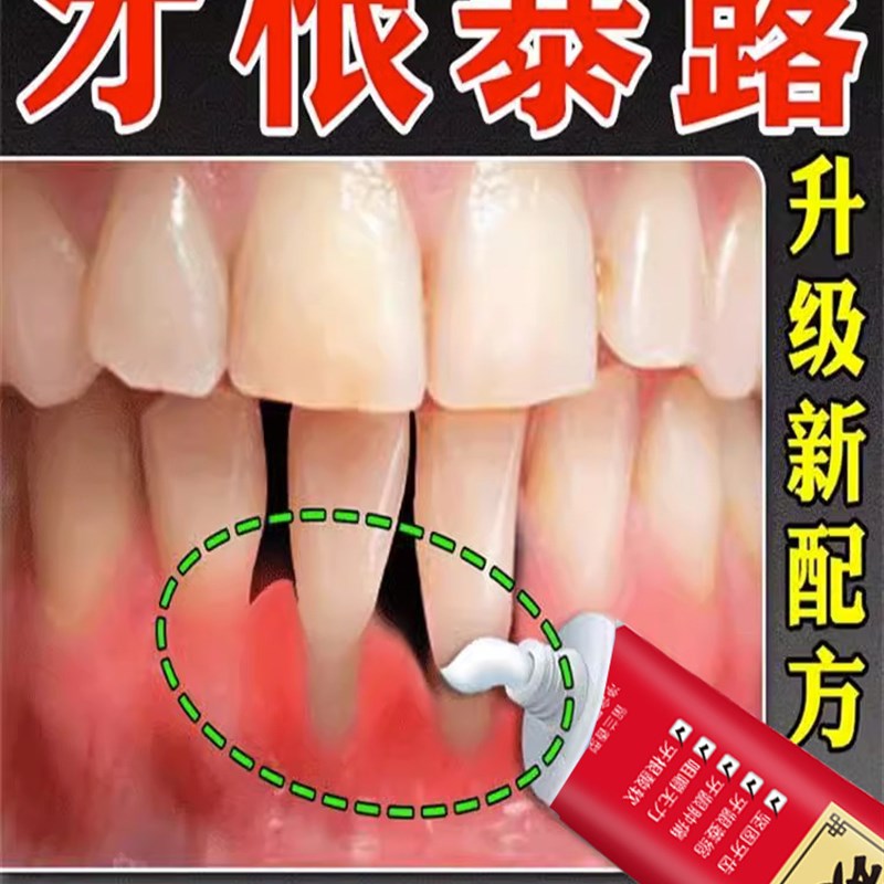 工厂销100%治好牙o松】牙齿洁离剂牙齿松动固齿牙膏修复牙萎缩专