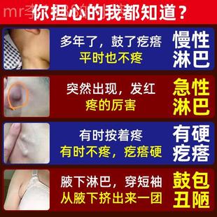 淋巴结消散膏颈部淋巴疼痛疏通腋下硬块结节淋巴结肿大疏散神 推荐