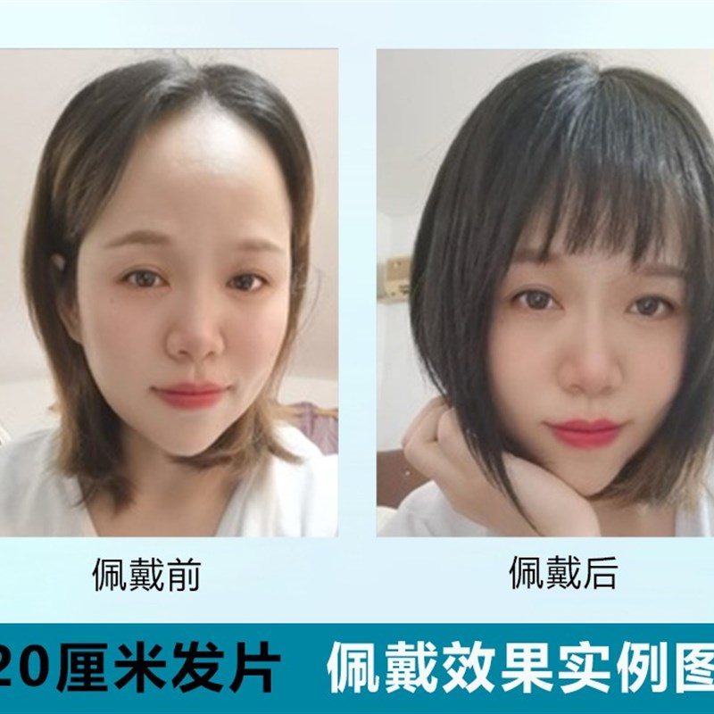 头顶遮白发稀少补发假发片中老年妈妈直发透气短发长发全真人发丝