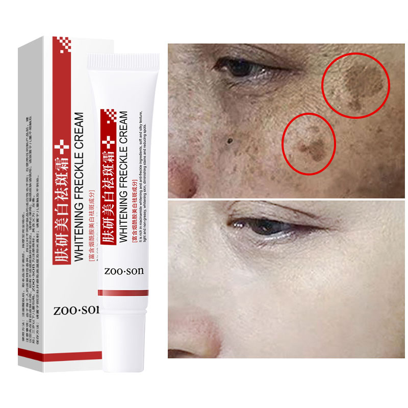 速发Facial remover rapidamente manchas escuras creme elimina