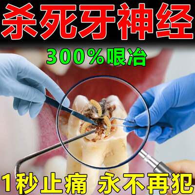 治牙疼牙痛止疼药速松牙龈肿痛水专用杀死牙齿神经效上动火立可停