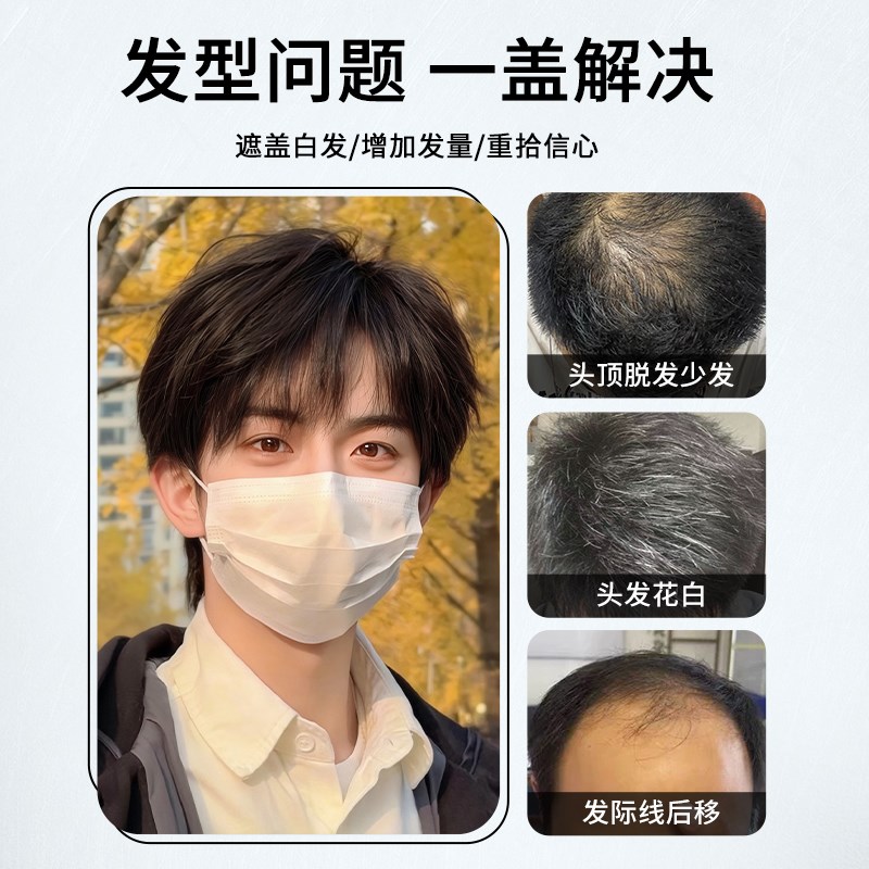假发男短发韩式日常微分碎盖仿真人发蓬松头顶增发量遮白发假发套