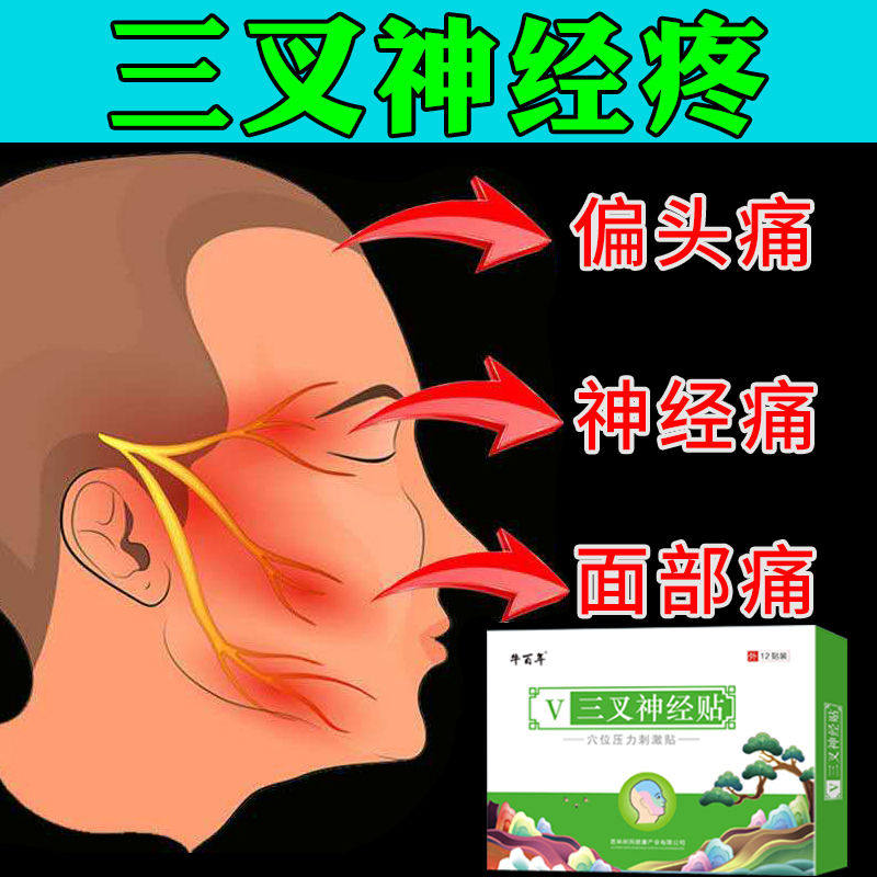【脑袋疼】三叉神经疼头痛偏头痛神经性头疼面部刺疼头晕头胀疼贴