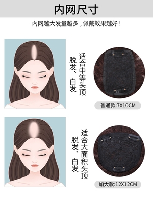 头顶补发女短卷发遮白发假发片增发量h真发补发顶小玉米烫蓬松假