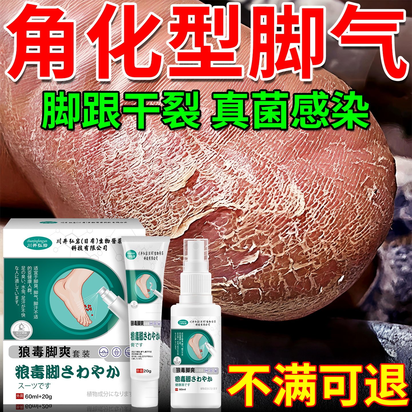角化型脚气专用治脚气止痒杀菌脱皮脚底出汗长水泡烂脚丫脚气喷剂