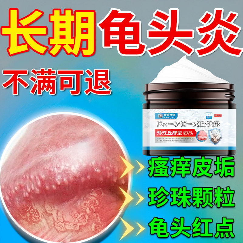 珍珠丘疹男性冠状沟龟头炎包皮炎阴茎小疙瘩丘疹白点去除专用软膏