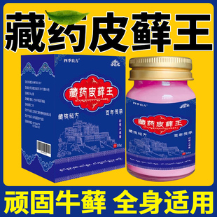 藏族皮藓王牛皮药膏头皮股银去屑病皮肤杀菌症止痒抑菌正品专用癣