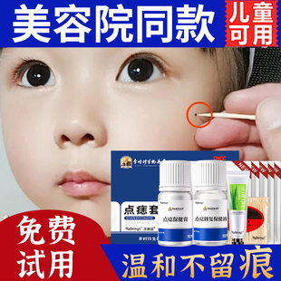 点痣膏无痕正品药膏水点痣笔脸部专用去非药水液不留疤神器旗舰店