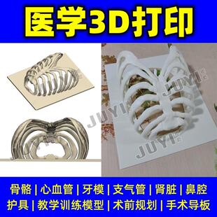 医学3D打印胸廓肋骨模型/CT三维重建/人体胸腔镜训练演示实验模拟