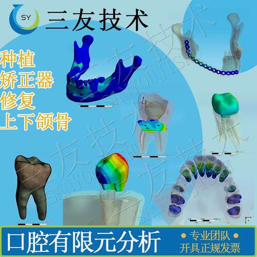 口腔有限元分析/医学有限元代做mimics/abaqus/ansys