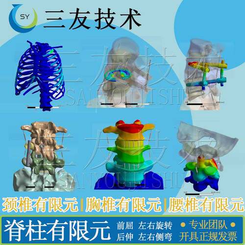 代做Mimics建图/医学生物有限元建模分析/3D打印CT模型及咨询