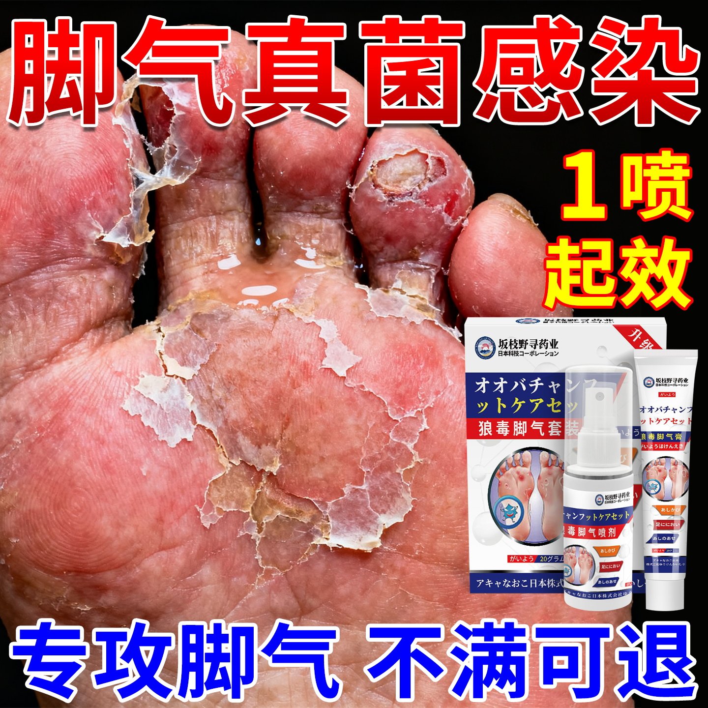 狼毒脚气止痒脱皮杀菌真菌感染臭皮肤消毒护理（消）
