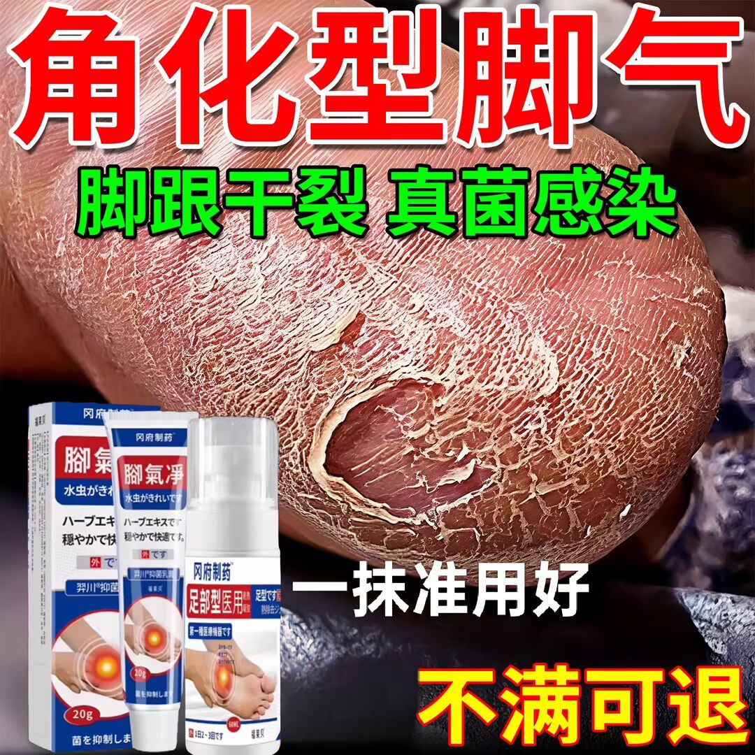 日本狼毒脚气烂脚丫药脱皮糜烂脚趾杀小水泡感染角化型喷剂乳膏