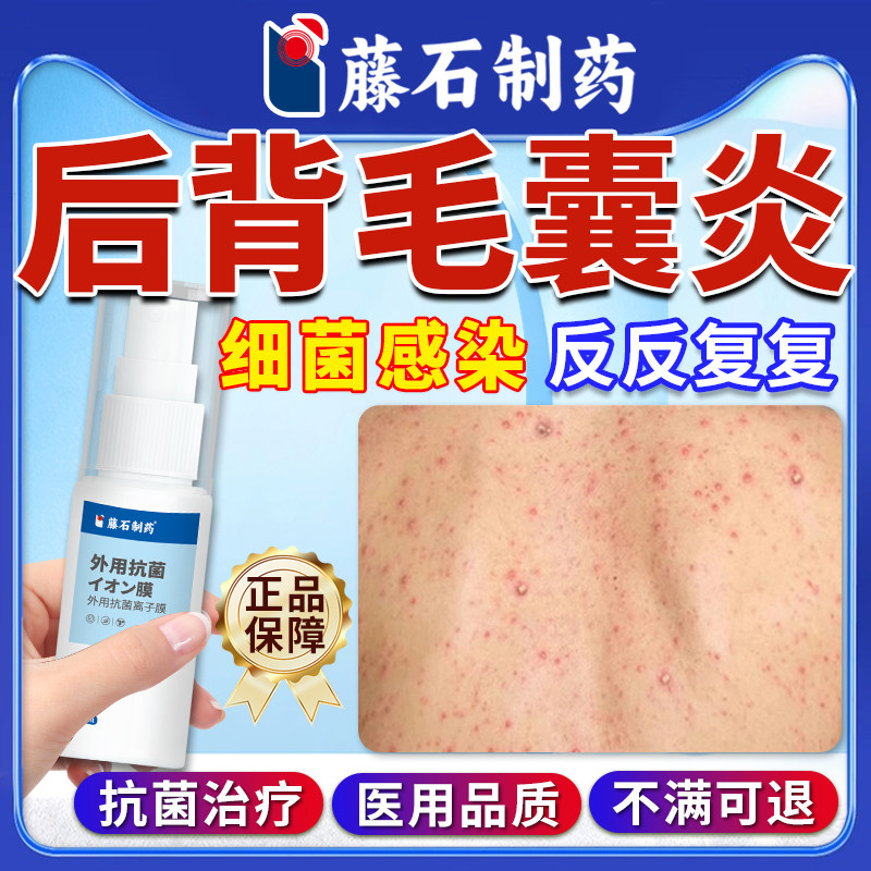 藤石制药后背长痘痘毛囊炎细菌感染前胸后背部痒除螨祛痘喷雾剂LQ