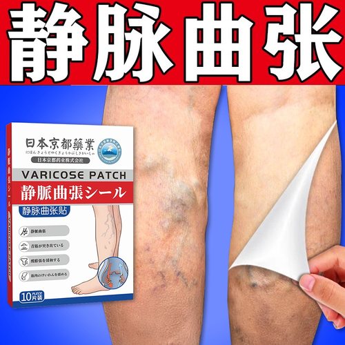 静脉曲张冷敷凝胶专用贴脉舒精索蚯蚓青筋凸起腿部修复红血丝正品