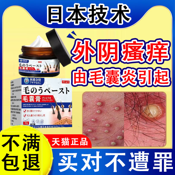 外阴瘙痒有小疙瘩毛囊炎专药膏用女性私处阴毛瘙痒长硬疙瘩脓包Y