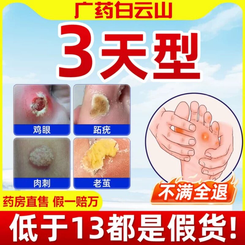 白云山鸡眼贴鸡眼膏药水瘊子手足部去脚底脚趾部跖疣老茧根肉刺qx