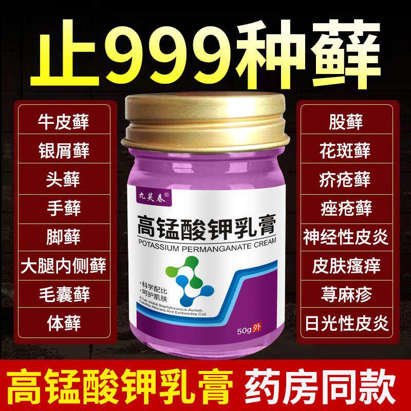 医用高锰酸钾乳膏牛皮藓银屑藓手足藓大腿内侧藓股藓体藓头藓专用