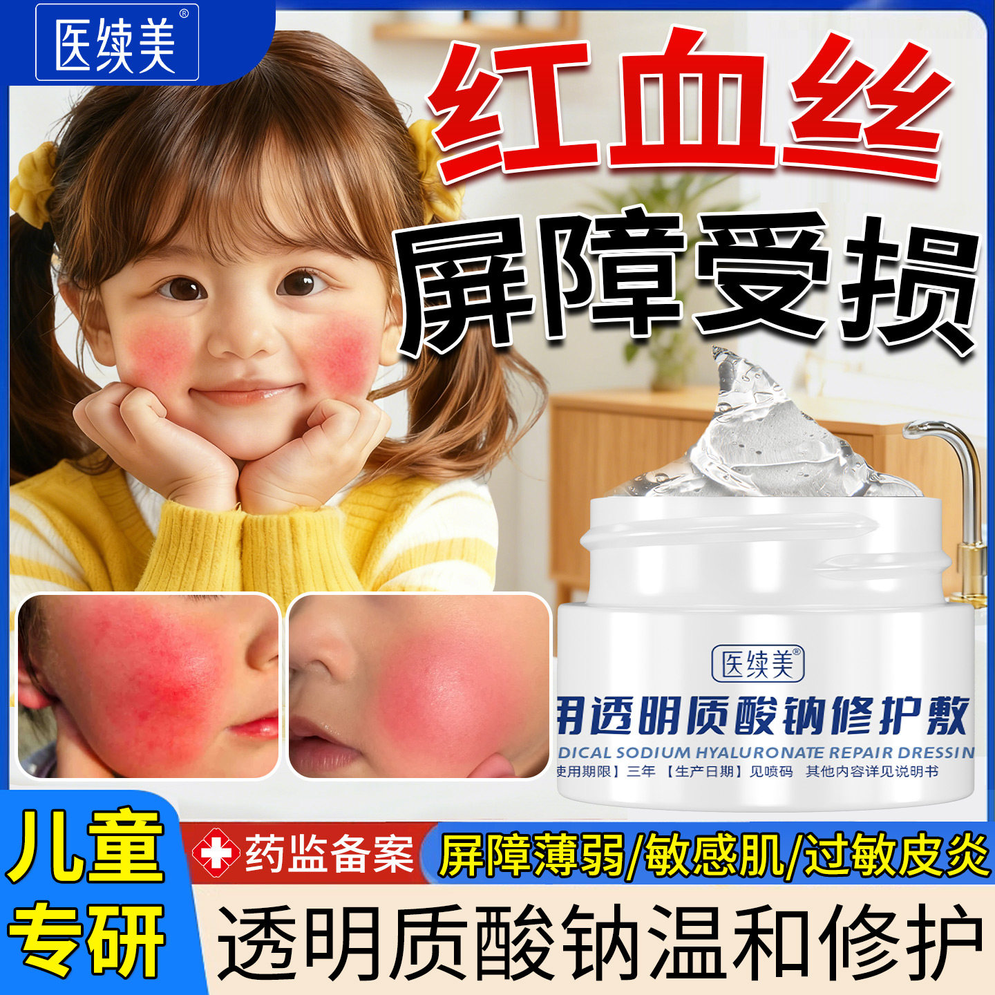 儿童红脸蛋去红血丝修复角质层改善敏感肌肤增厚护脸部泛红面霜SY