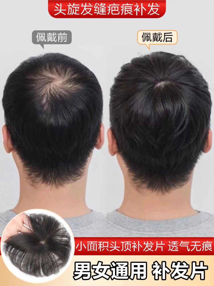 假发片男士头顶补发片全真发头旋发缝遮盖伤疤稀少脱发后脑勺女士