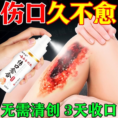 伤口愈合喷雾促进伤口长肉快速结痂喷雾止血云南金创粉去腐生肌膏