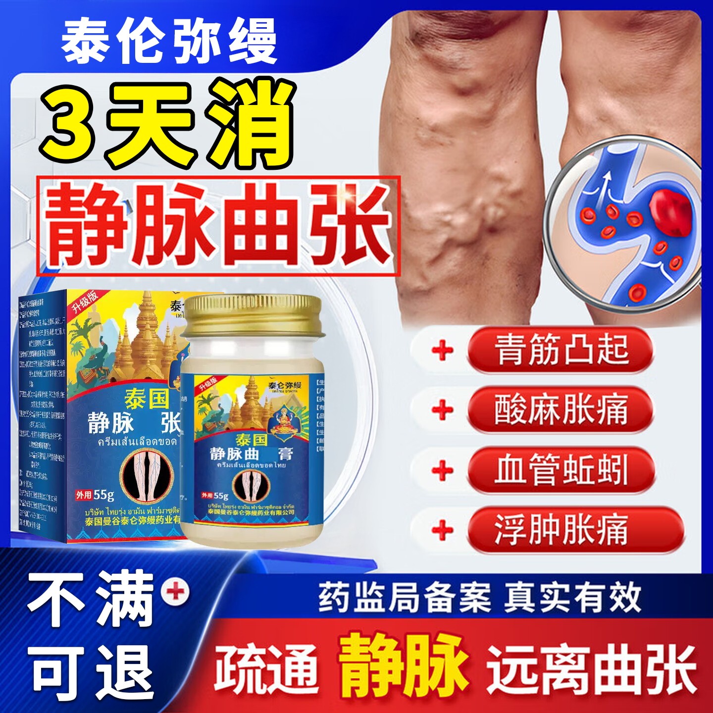 静脉曲张专用冷敷凝胶膏特效青筋凸起蚯蚓腿痛酸肿红血丝筋脉炎