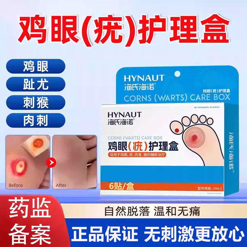 脚鸡眼贴止痒去垠除老茧去跖疣寻常疣专效用膏跖疣瘊子眼刺扁平疣
