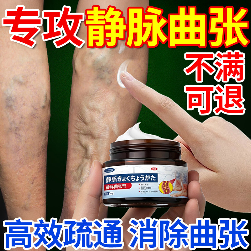 静脉曲张膏官方旗舰店静脉炎贴膏脉管炎老烂腿青筋凸起筋脉曲张膏