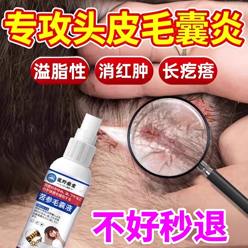 日本头皮毛囊炎喷雾抑菌止痒护理液脂溢性皮炎去红疙瘩头皮红肿用