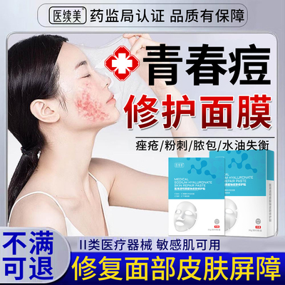 青春痘去搭祛痘膏男女学生青少年初中生正品粉刺闭口痤疮面膜E8