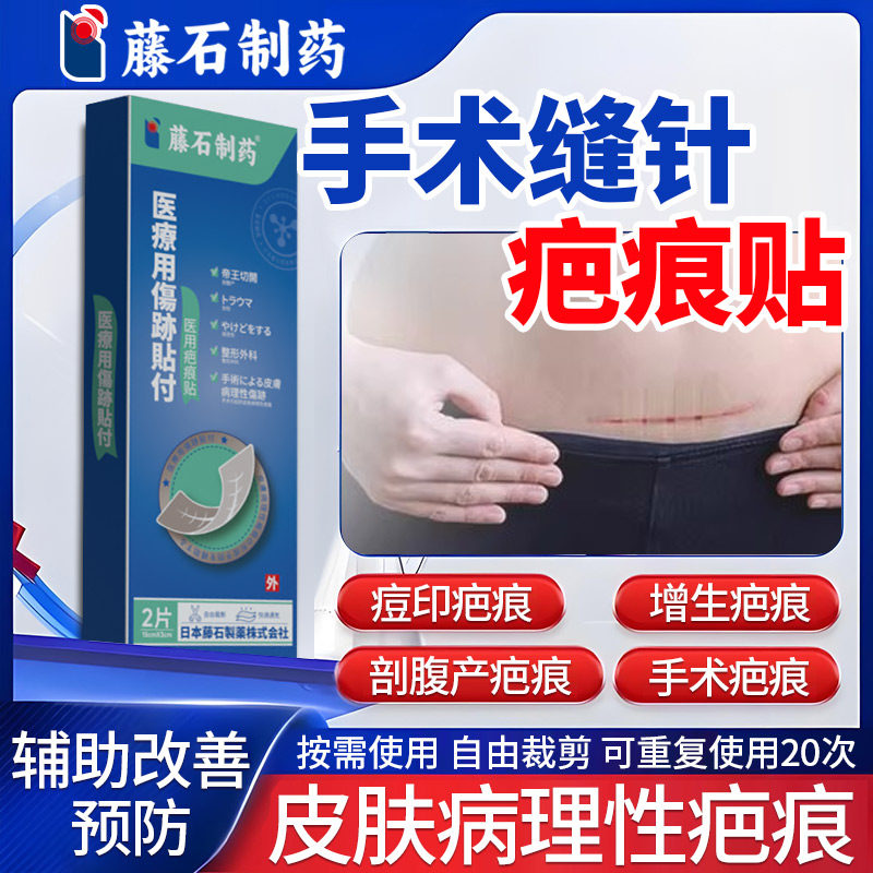 手术缝针疤痕搭修复除疤膏手术伤口刀口祛疤贴剖腹产护去搭凝胶LQ