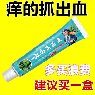 【爆卖100W】云南真菌王手痒脚痒全身快速止痒皮肤瘙痒干痒特效膏