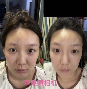 反馈 口服医美III型胶原 婷二专享