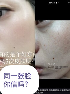 正品官方认证源泉秀肤针对皮肤配产品《链接》