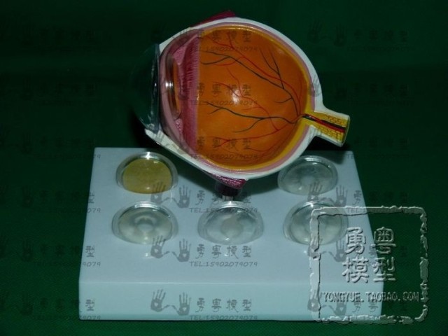 眼球疾病 人体眼球晶体病变 青光 眼模型 人体模型