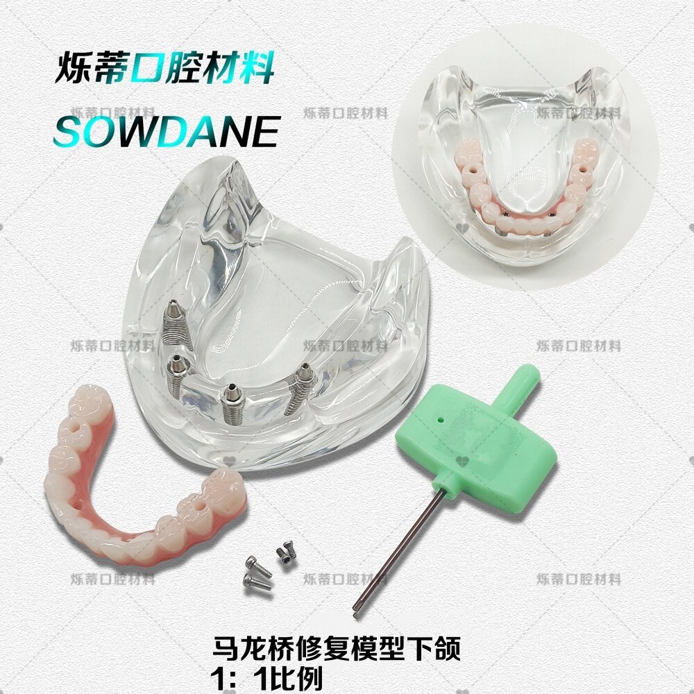 牙科马龙连桥义齿修复模型仿真义齿种植口腔教学牙模型