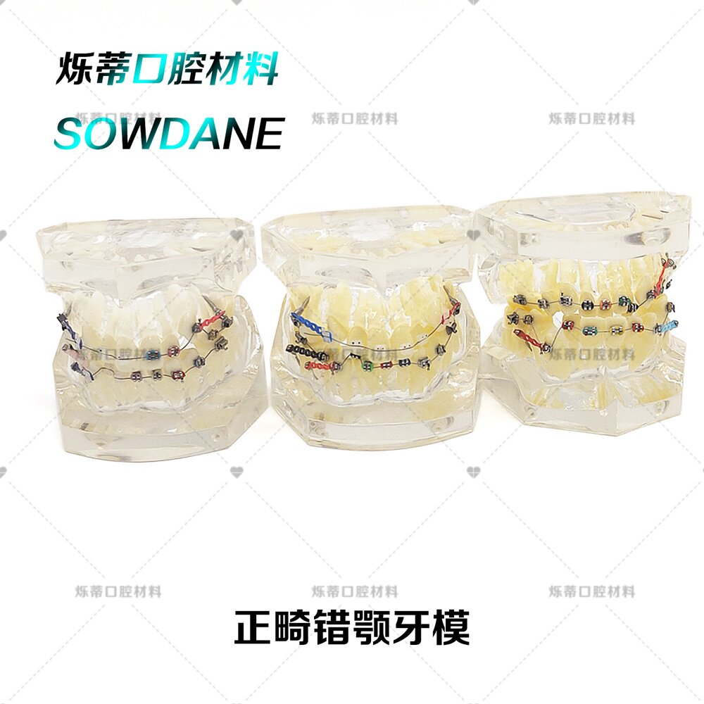 牙科正畸错颌畸形 带拔牙矫正模型 带钉透明医患沟通教学两种对比