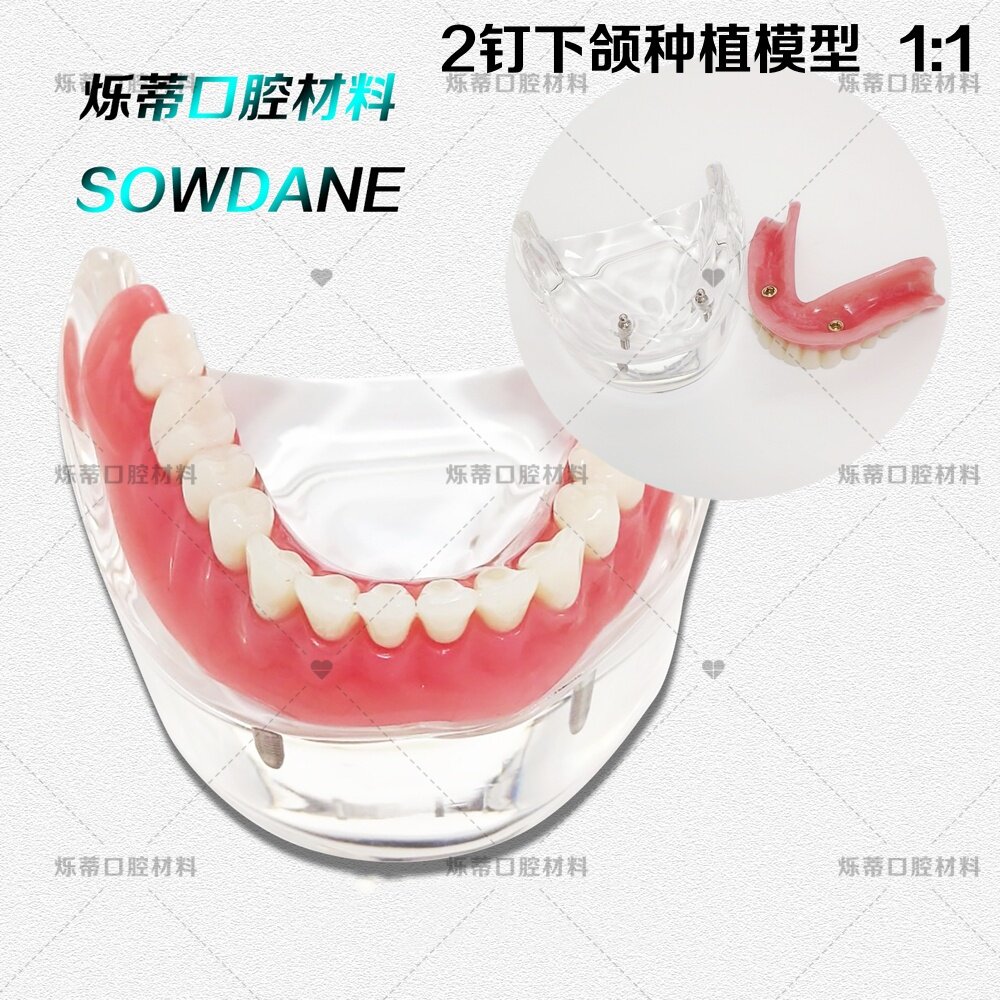 牙科2钉下颌种植模型齿科