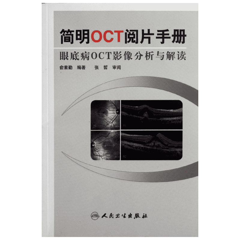 简明OCT阅片手册 俞素勤 正版书籍 新华书店旗舰店文轩官网 人民卫生出版社