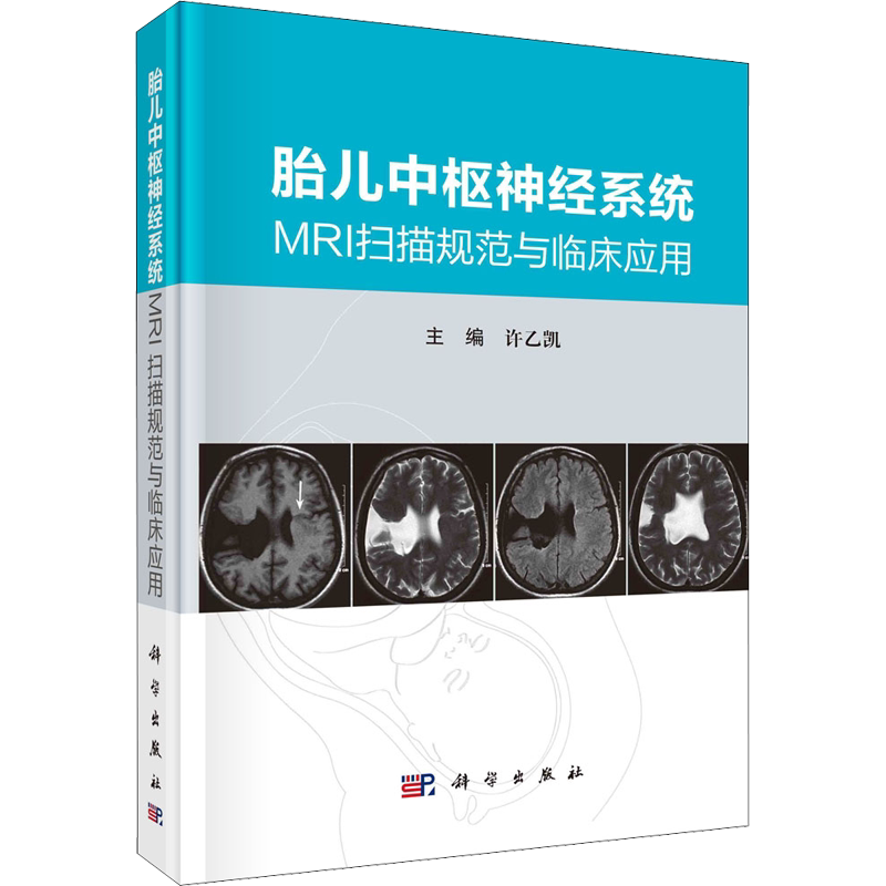 胎儿中枢神经系统MRI扫描规范与临床应用 正版书籍 新华书店旗舰店文轩官网 科学出版社