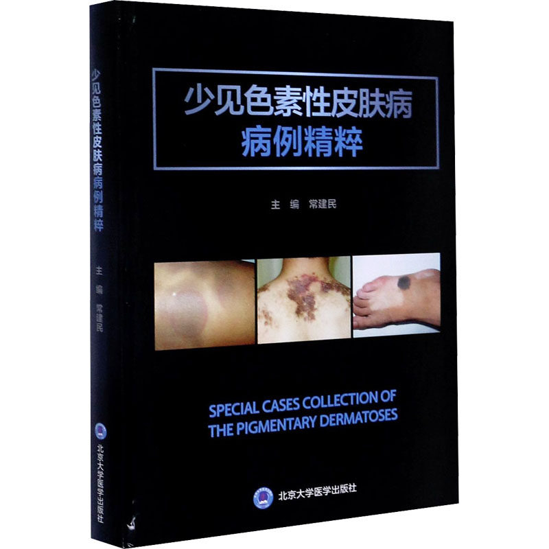 少见色素性皮肤病病例精粹 正版书籍 新华书店旗舰店文轩官网 北京大学医学出版社