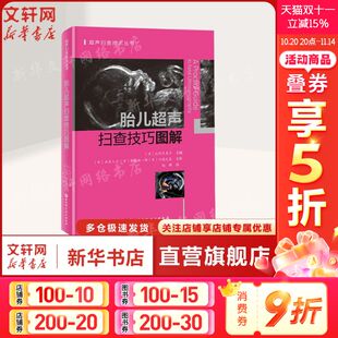 各位为对象正版 胎儿超声扫查技巧图解 初学者和平时进行胎儿筛查检查 胎儿超声波检查 书籍 覆盖ISUOG孕期筛查全路径实用指导书