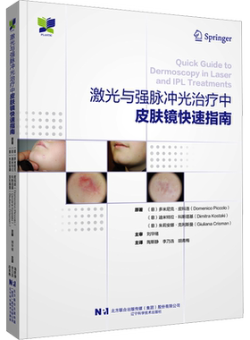 激光与强脉冲光治疗中皮肤镜快速指南 (意)多米尼克·皮科洛,(意)迪米特拉·科斯塔基,(意)朱莉安娜·克利斯曼