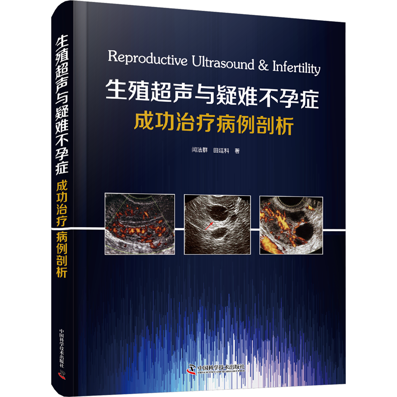 生殖超声与疑难不孕症成功治疗病例剖析 闫法群,田廷科 正版书籍 新华书店旗舰店文轩官网 中国科学技术出版社