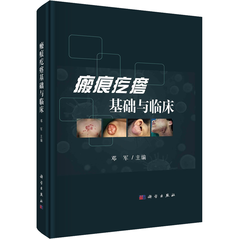 瘢痕疙瘩基础与临床 正版书籍 新华书店旗舰店文轩官网 科学出版社