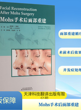 Mohs手术后面部重建 正版书籍 新华书店旗舰店文轩官网 天津科技翻译出版有限公司