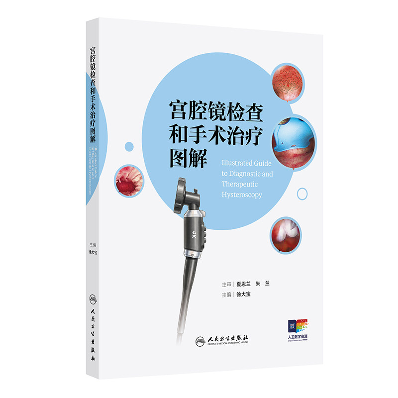 宫腔镜检查和手术治疗图解 正版书籍 新华书店旗舰店文轩官网 人民卫生出版社