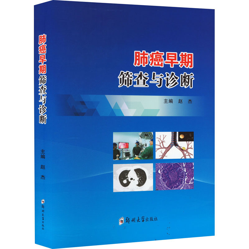 【新华文轩】肺癌早期筛查与诊断 正版书籍 新华书店旗舰店文轩官网 郑州大学出版社