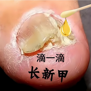 【效果太好】快速祛除99%灰钾真菌 滴一滴 旧钾换新钾 男女同款