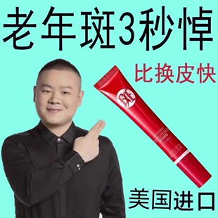 【净斑太好用】除斑溶斑霜斑点黑色素色斑雀斑老年斑晒斑美白精华